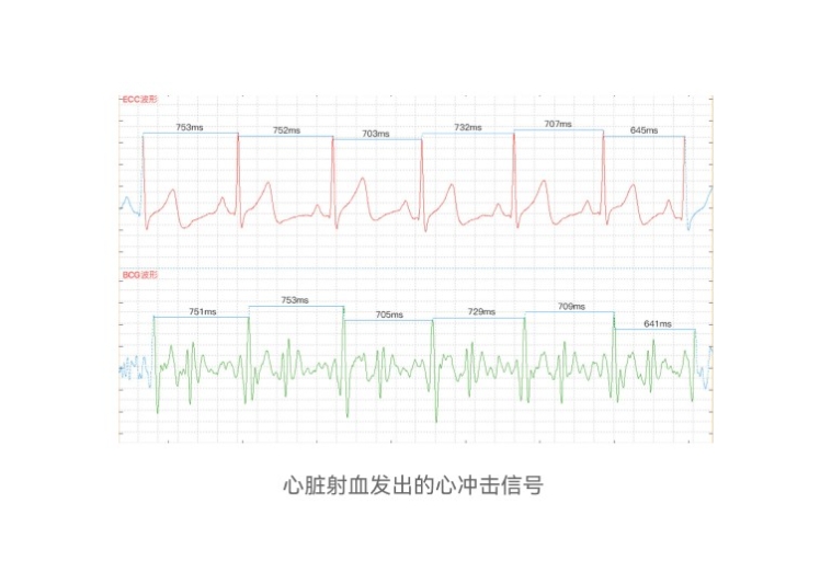 edan监护仪的创新与突破